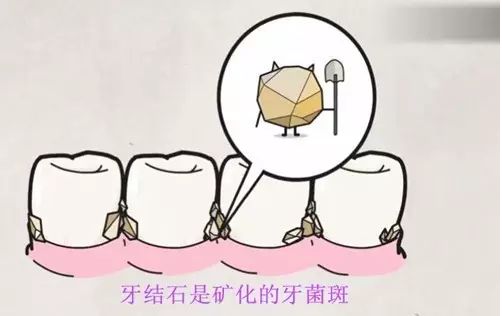 湖南正颌手术大概需要治疗费用多少(2023湖南正颌手术价格范围：4874-6482元)