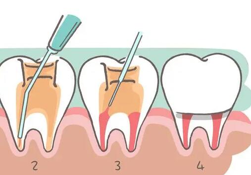 湖南永州比较好的牙科诊所是哪家？种植牙手术痛苦吗？真实受术者分享经验