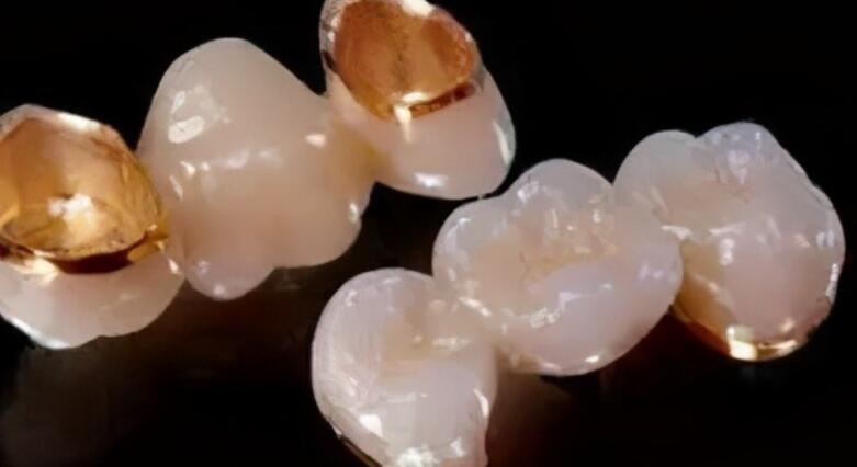 佛山哪家医院的牙齿美白技术好？价格表附上