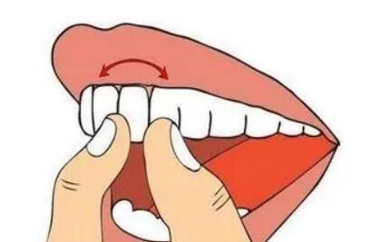 成都瑞泰口腔医院收费：补牙拔牙价格揭秘，详细费用曝光！