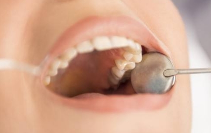 合肥儿童正畸哪个医院好？推荐专家选择多的正畸医院