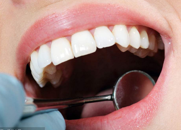 湖南哪些牙科机构做种植牙效果好？这八家牙科机构的价格实惠吗？