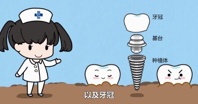 湖南种植牙哪家医院好？选择种植牙最好的医院，问问这些关键问题！