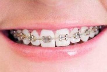 兰州种牙哪家医院好？白领族、学生族、老年人推荐的种牙医院有哪些？