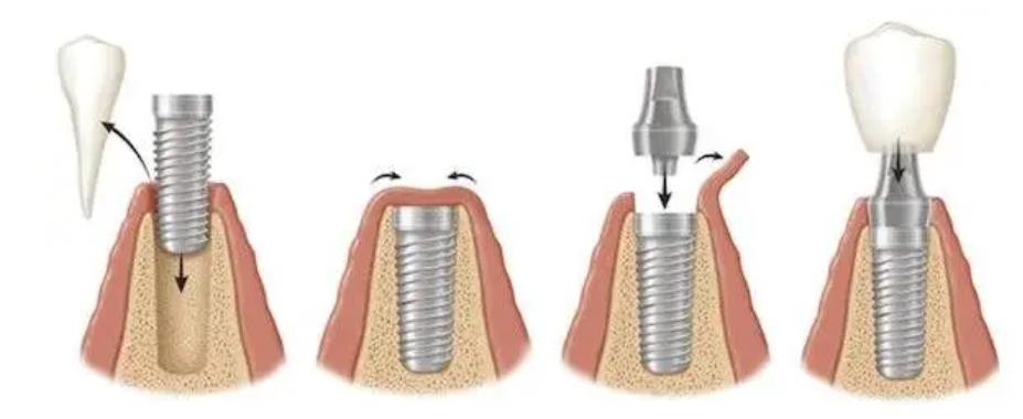 如何选择合适的永州牙齿矫正医院？牙博士口腔、中南口腔入围成功！