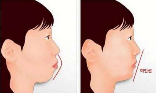 上海薇琳口腔医院：准确地址电话发布！专家牙齿矫正、技术评估及价格揭秘！