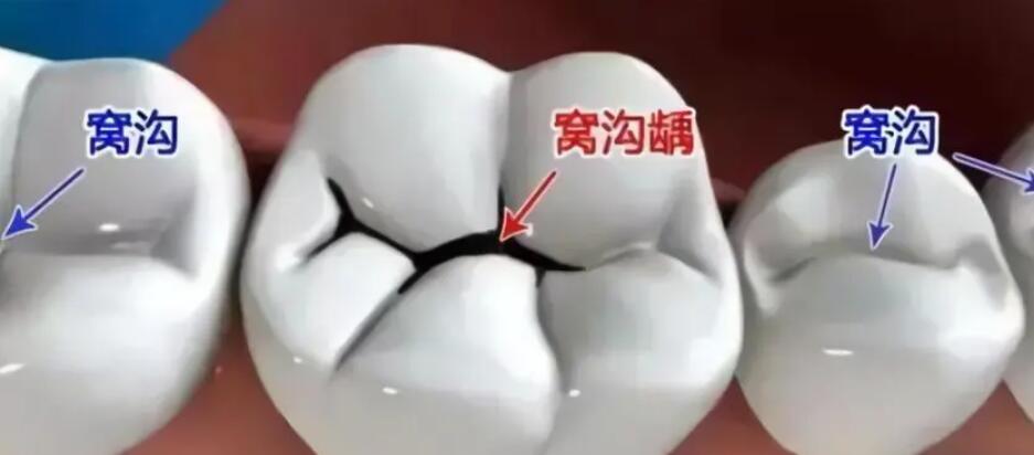 深圳格伦菲尔医生团队和收费情况揭秘