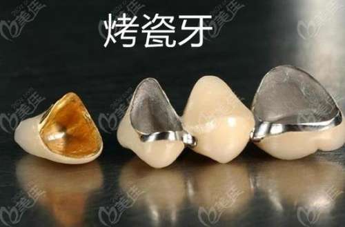 广州新塘德伦口腔医院口碑如何？种植牙、牙齿矫正技术专业，价格合适