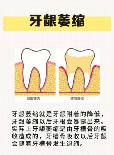 沈阳哪家牙科医院适合孩子就诊？儿童口腔医院名单大揭秘！