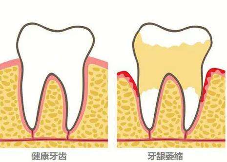 上海松丰口腔医院的评价如何？用户分享正规齿科服务价格实惠