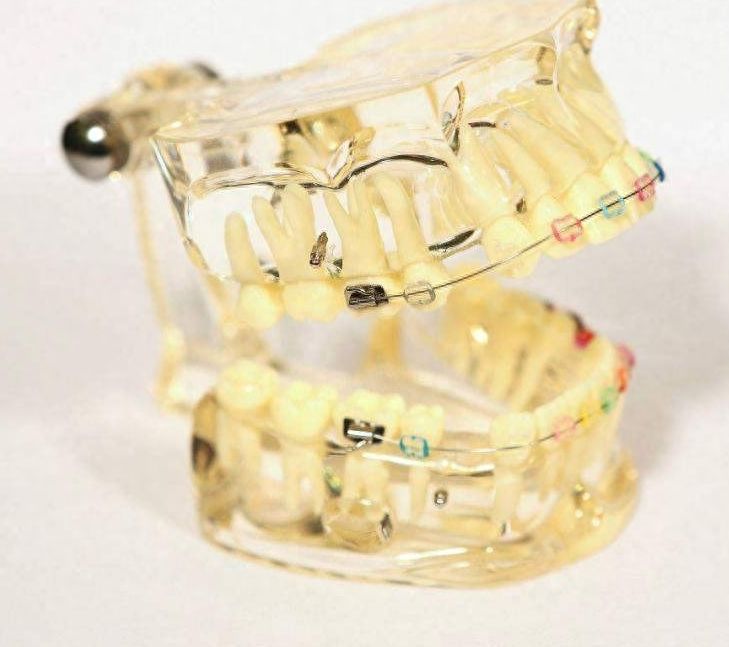 南充多生牙翻瓣手术医院推荐：口碑技术双在线！