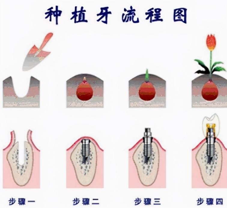 雅安牙龈萎缩治疗医院推荐-口碑排名前十参考