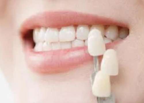 揭秘补牙费用！绵阳地区补牙价格一览，一颗牙齿需要多少费用？