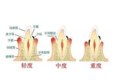 杭州哪家牙齿矫正医院口碑好，专业水平受赞誉？