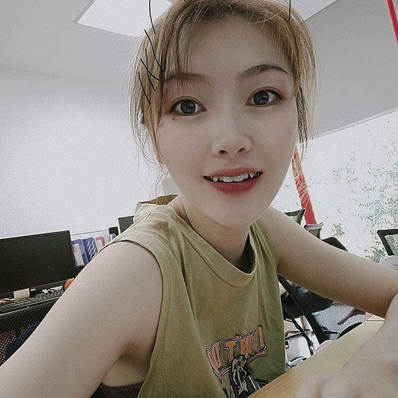 牙齿矫正案例效果图