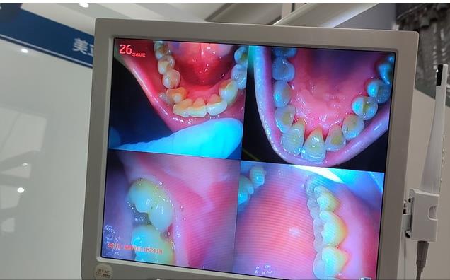 东莞美立方口腔医院拍片