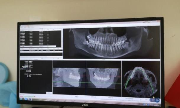 贵港蓝天口腔医院拍片