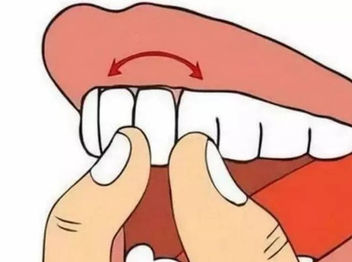 牙齿松动且疼痛的原因大致有哪些？牙齿松动痛怎么快速止痛简单的办法有哪些？
