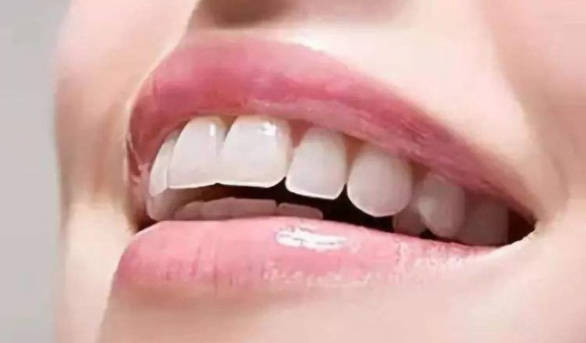 冷光美白牙齿疼不疼？冷光美白牙齿需要做几次？