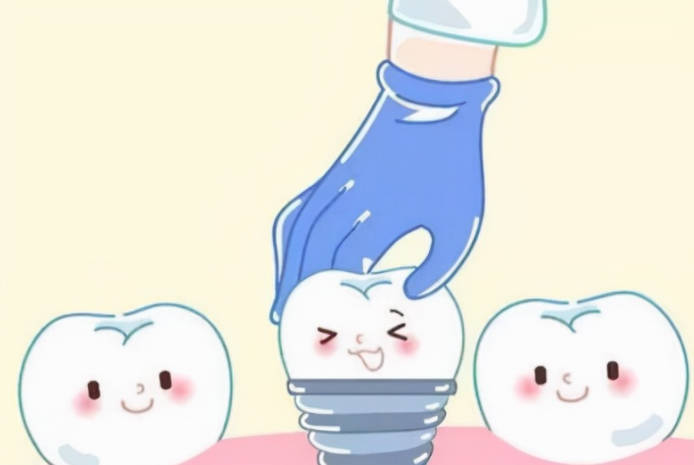 种植牙适合哪种人群?