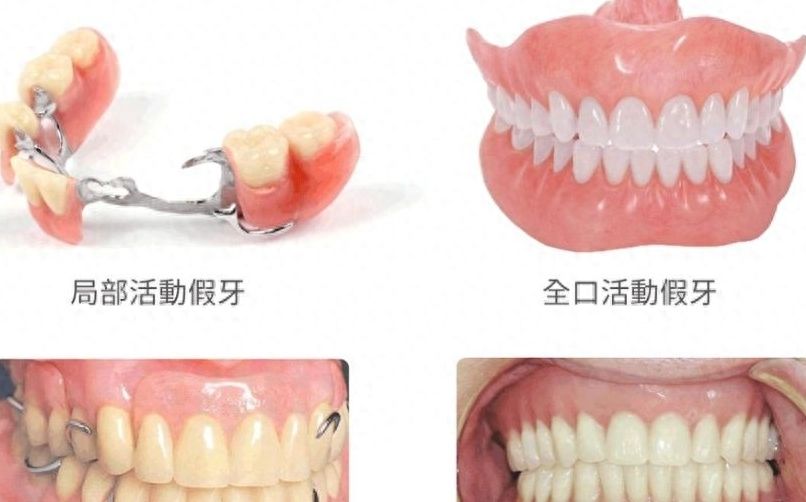衡水可恩口腔矫正：价格、效果一网打尽，9999元起!