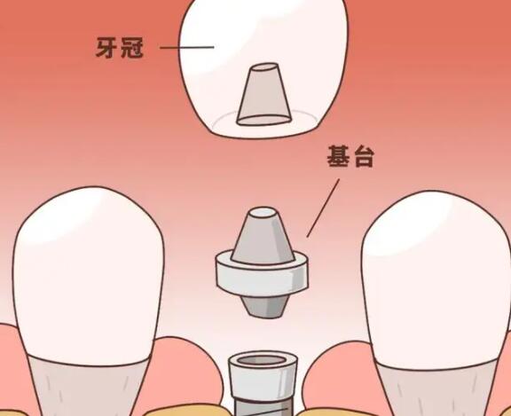 武汉口腔医院：专业技术与专家，全方位满足您的口腔需求