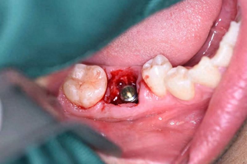 深圳龙华大浪百兴口腔诊所用户评价及口碑调查