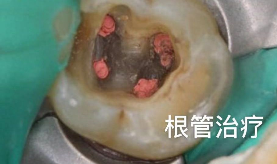 湘西口腔医院：公立还是私立？2024正畸、种牙、补牙价目表详解