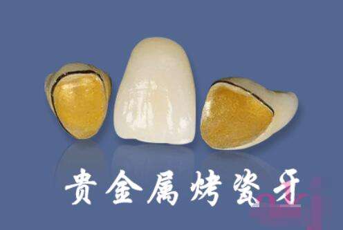 青岛维乐口腔专业牙齿矫正，学生优惠有多大？