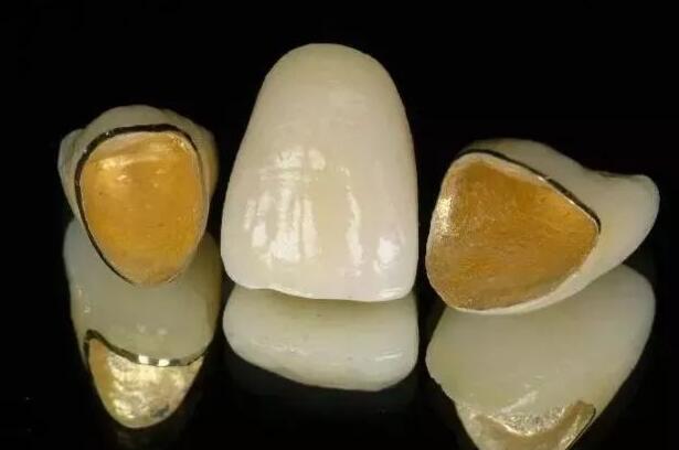 正常人的牙龈状况如何反映口腔健康？