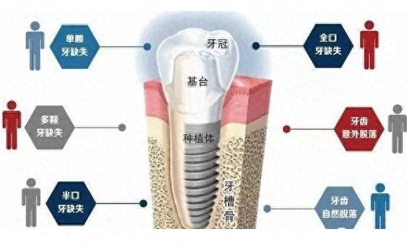 南通好评度高的牙科医院推荐：公立口腔医院大盘点