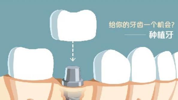 贵阳口腔医院洗牙效果如何？