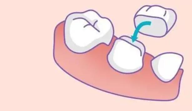 【口腔正畸】一个不错的哈尔滨齿科中心，专业技术获口碑推荐！