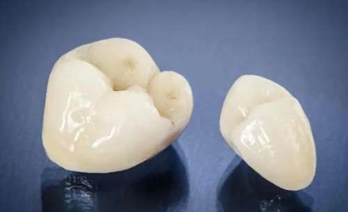 广州壹加壹口腔医院种植牙3980元，口碑如何？