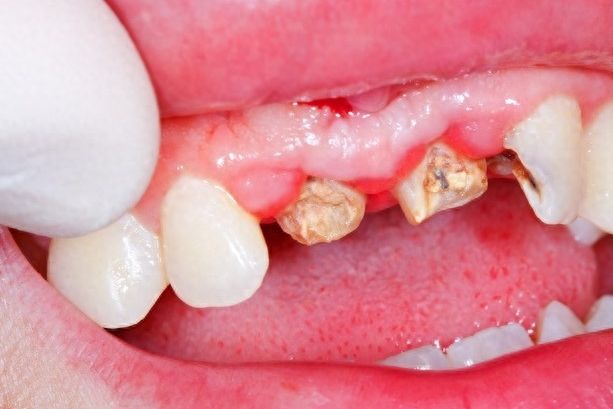 丽江德柏口腔：专业二级口腔医院，种牙、牙齿矫正价格实惠