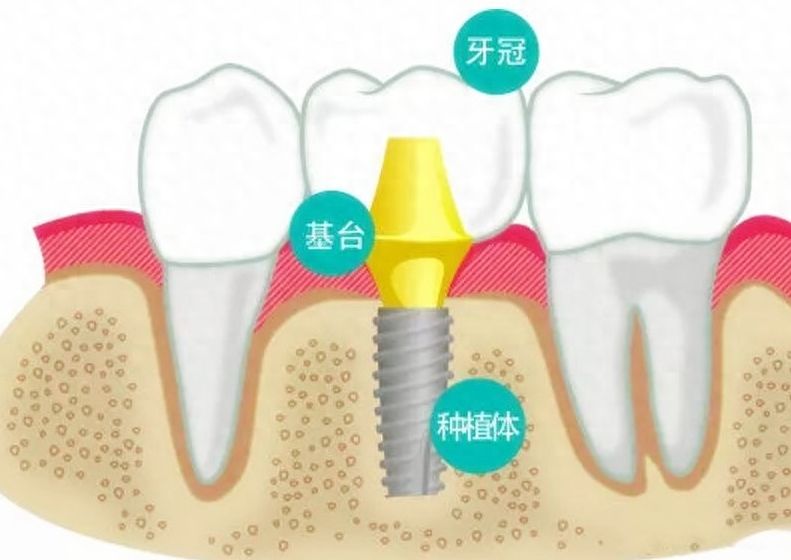 全面呵护口腔健康，王艳霞师傅专治各种颚骨不齐，效果如何？