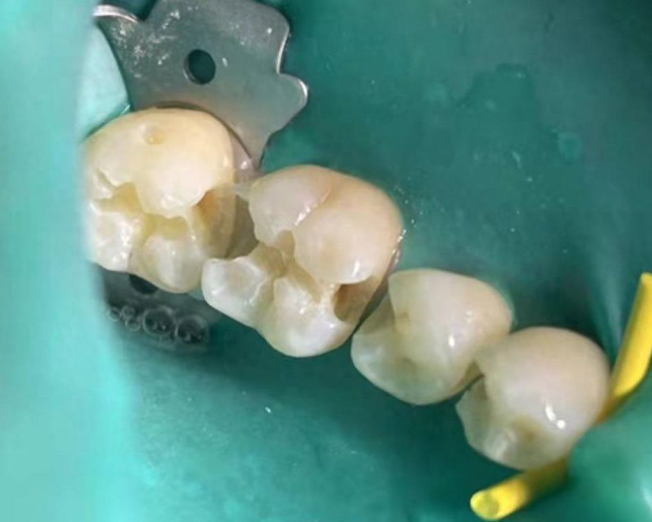 威海华海口腔：权威正规牙科，医生技术精湛，就诊划算