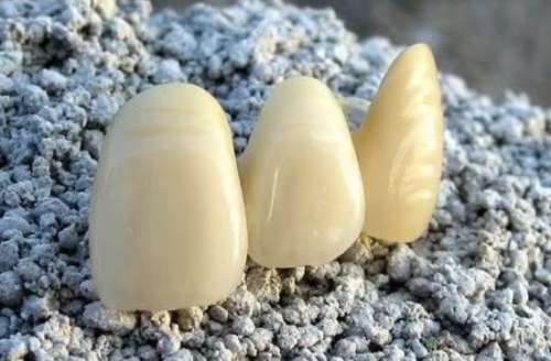 烤瓷牙修复必要时为何需要拔牙