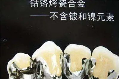 韩国种植牙，挑选种植系统需知，了解四个品牌哪个更靠谱！