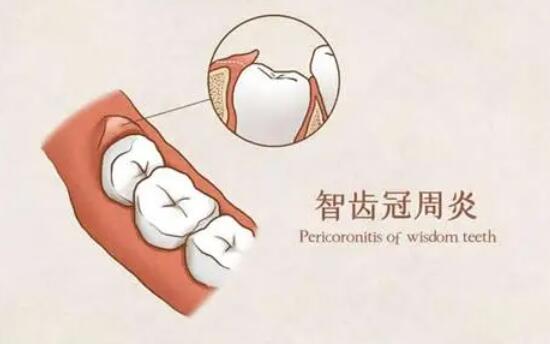 南昌口腔医院半口种植领先榜单：权威案例与实惠价格引领者，2025年度优选口腔医院