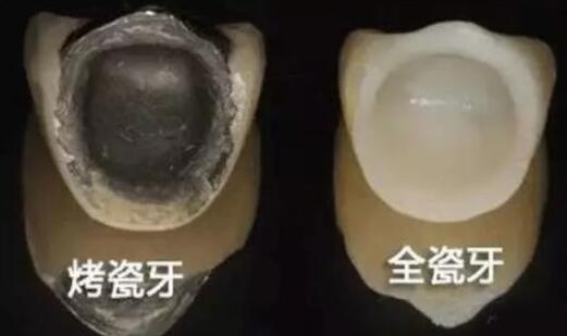 2025成都牙性反颌矫正信赖牙科医院：专业推荐十大优质选择