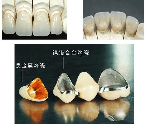 2025郑州牙龈修复手术最佳牙科医院排行榜